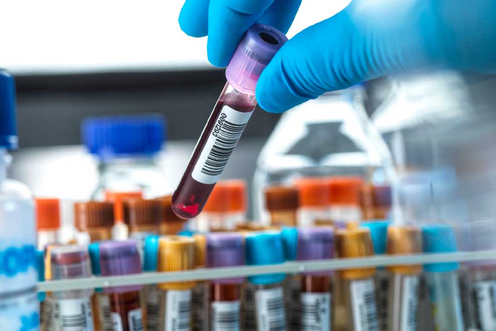 ¿Cuándo un examen puede ser una señal de alerta real?