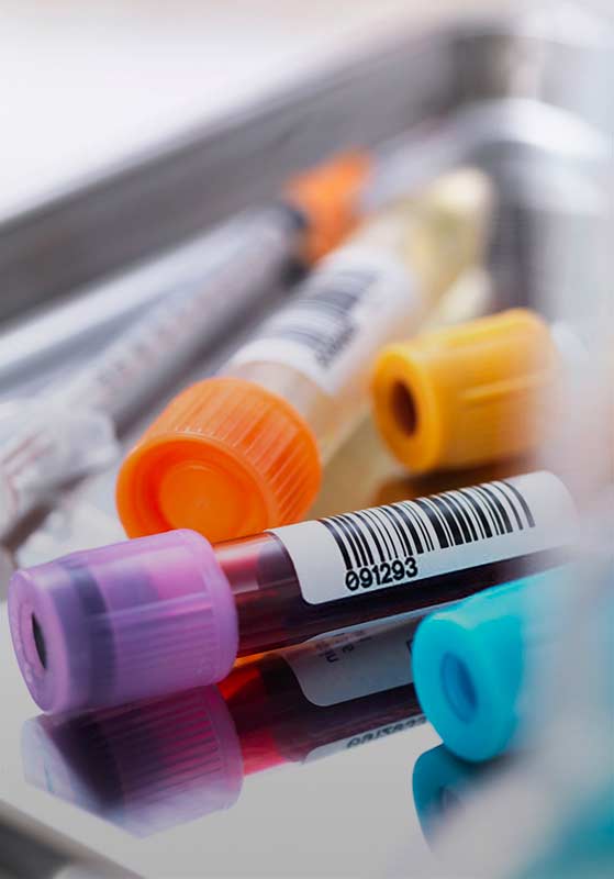 Cultivos microbiologicos – Laboratorio San Andrés