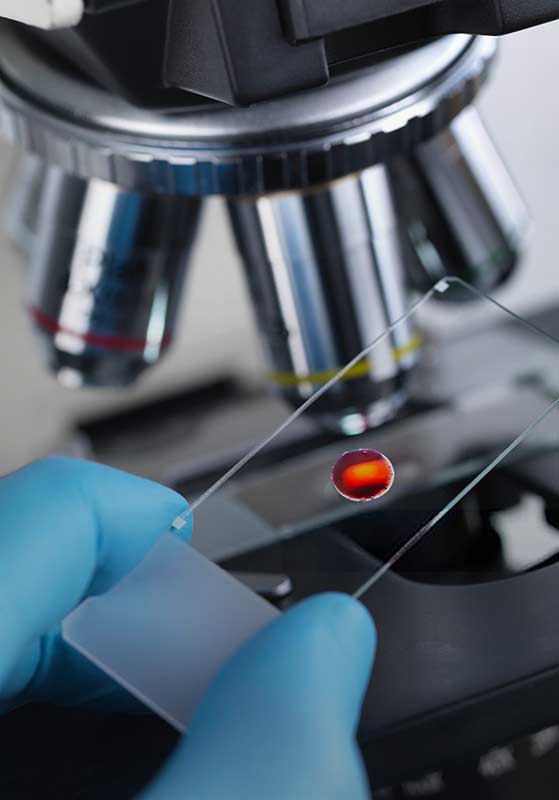 Marcadores Cardiacos – Laboratorio San Andrés