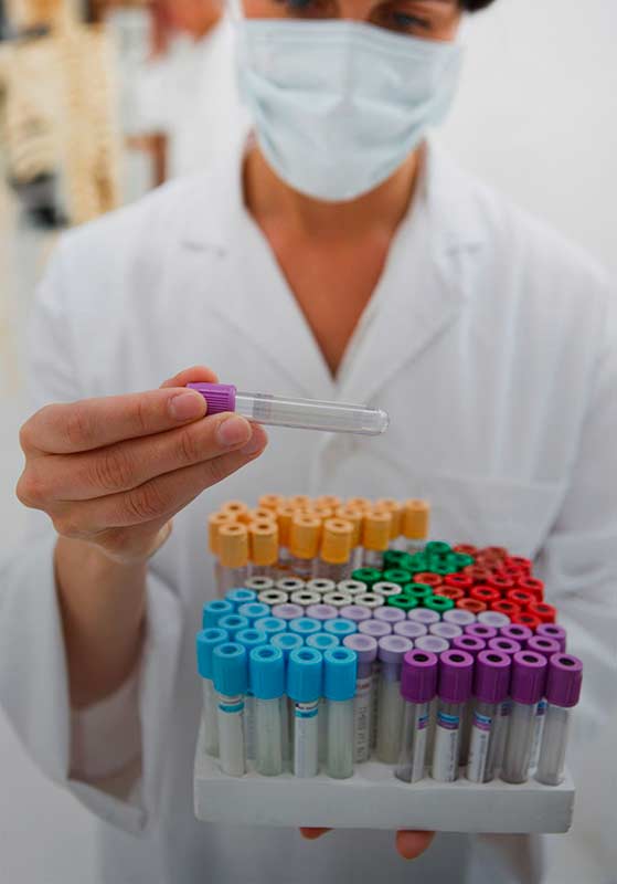 Exámenes de Orina – Laboratorio San Andrés