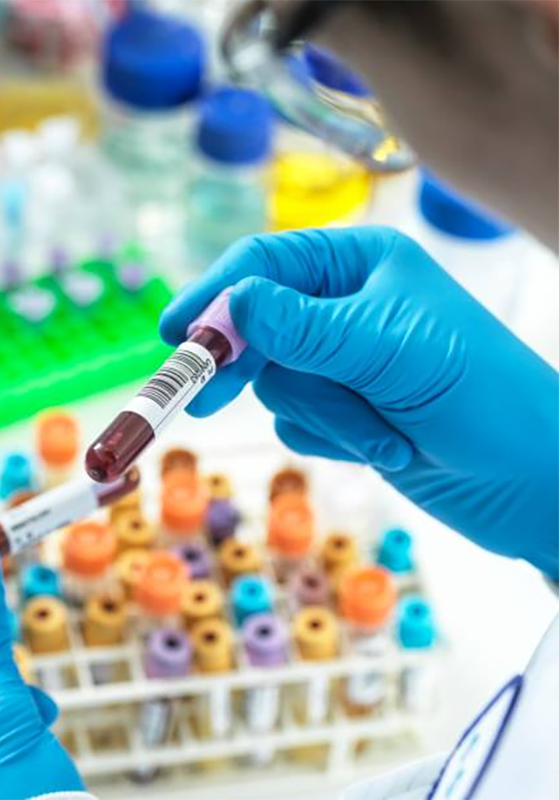 Hormonas – Laboratorio San Andrés