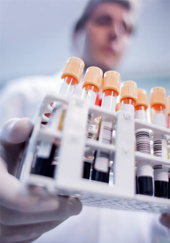 Exámenes Inmunologicos y Serológicos – Laboratorio San Andrés